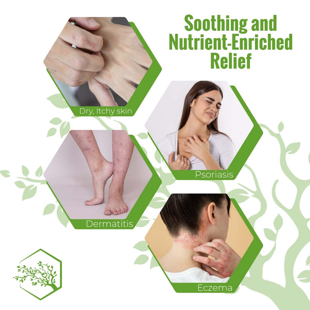 Moisturizing Eczema Body Wash – Gentle Psoriasis Body Wash for Itchy, Dry Skin Relief – Eczema Soap for Redness and Flareups – Hydrating Cleanser for Women and Men