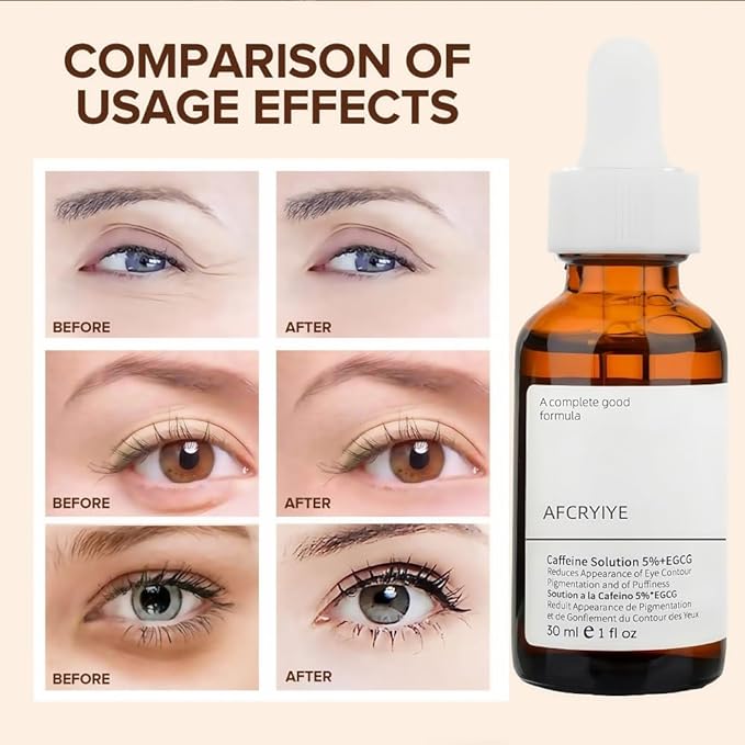 New Caffeine Solution 5%+ EGCG, Facial Caffeine Eye Serum, Moisturizing Eye Solution, Can Reduce Dark Circles And Puffiness.Caffeine Under Eye Serum,30（ML）