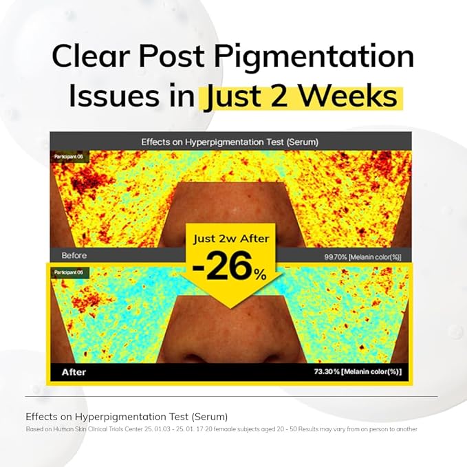 MIMUMIMU NIACINDY Lightweight Serum for Clarity Skin with Niacinamide 5% + Thioctic Acid, for Sensitive skin, Pore Smoothing, Korean Glass Skin, Glow Booster, Fragrance-Free (30ml/1.01 fl.oz)