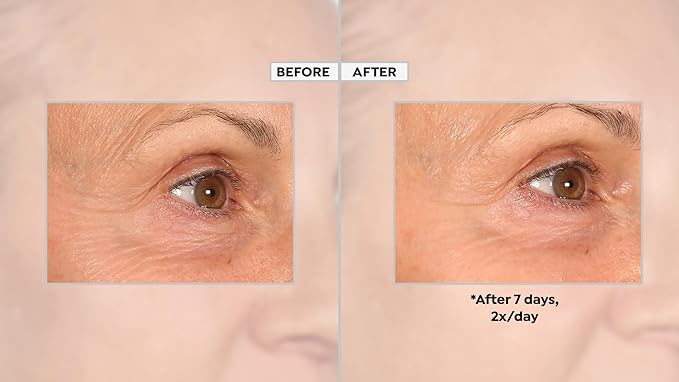 PRAI Beauty - Ageless Eye Advanced Eye Serum 0.5 oz