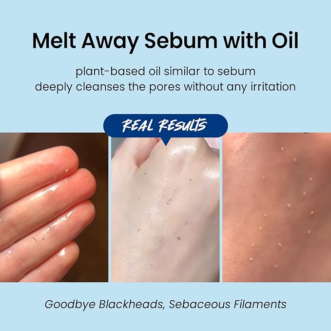 coxir ULTRA HYALURONIC CLEANSING OIL Mini Travel Size l Korean skincare, Hydrating, Smoothing, Calming, Moisturizing, Makeup Removal with Hyaluronic Acid [0.67 Fl.oz(pack of 1)]