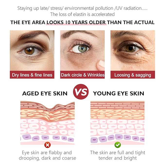 Retinol Eye Cream, Anti-Aging with Vitamin C & Ceramide for Dark Circles, Wrinkles & Fine Lines, Crow’s Feet, 0.7 fl.oz