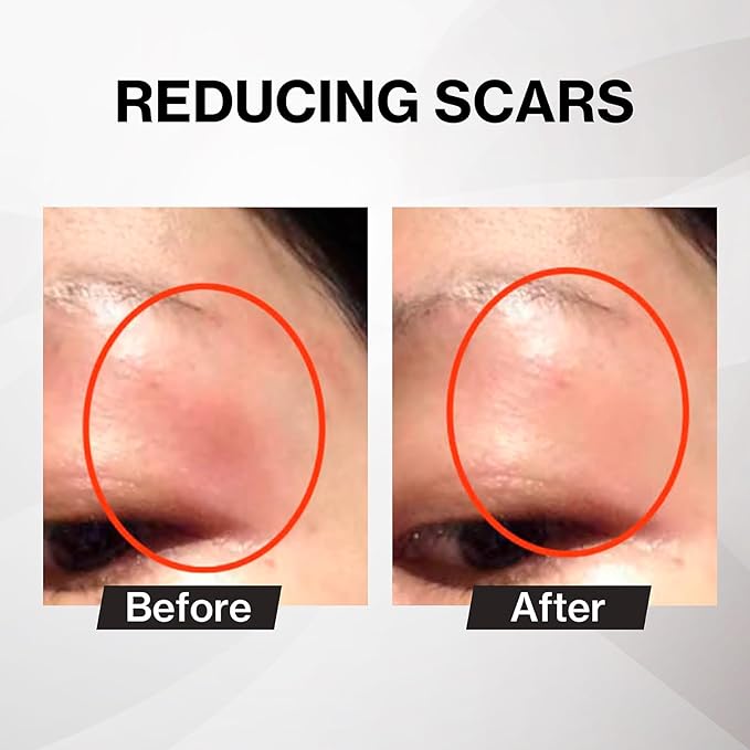 Japanese Placen Liposomal 200% Concentrated Serum, EGF, FGF, HUMANANO", Paraben Free, Alcohol Free, Mineral Oil Free, Cruelty Free (1month 1.01 fl oz)