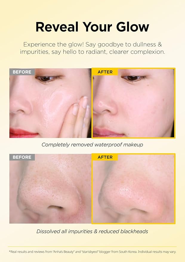 Hanskin PHA Pore Cleansing Balm, Gentle Blackhead Cleanser and Makeup Remover for Sensitive Skin [PHA/2.82 oz]