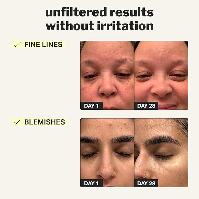 Cocokind Beginner Retinol Gel 0.1%, Improve the Appearance of Fine Lines and Uneven Texture without Irritation, Aloe and Cica to Prevent Dryness, 1 fl oz