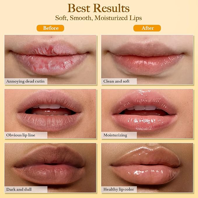 3PCS Turmeric Lip Balm and Turmeric Lemon Lip Exfoliator Scrub with Brush Set, Dark Lips Treatment for Smokers, Natural Exfoliator & Moisturizer Cracked, Dull, Reduce Fine Lines Lips