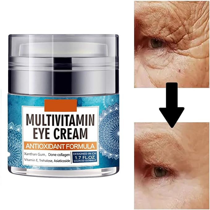 Eye Cream for Women, Multivitamin Eye Cream Under Eye Cream for Dark Circles Anti Aging and Wrinkle Deeply Moisturizing Reduces Bags Puffiness Face Tightening Eye Lift 1.7oz