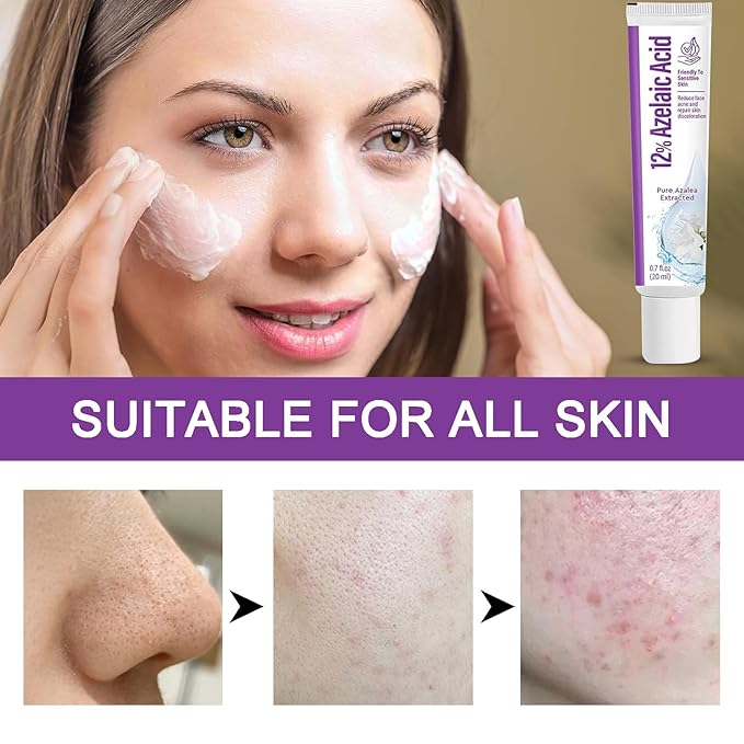 Azelaic Acid Serum 12% Azelaic Acid Cream, Azelaic Acid Facial Cream, Facial Serum with Hyaluronic Acid and Niacinamide, Redness Reducing Skin Care, Balances Excess Sebum