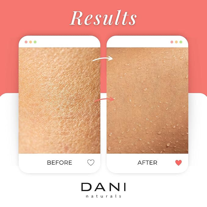 Naturals Exfoliating Sugar Scrub - Coconut Hibiscus, made with organic cane sugar and shea butter, gently exfoliates and deeply hydrates for smooth, radiant skin – 14 oz