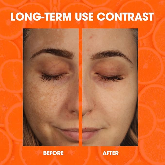 Super Vitamin C Face Serum for Women All-In-One Total Package Serum - Vitamin C, Hyaluronic Acid, Vitamin E, Caffeine - Hydrating, Lifting, Anti-Aging Reduce Wrinkles Age Spots