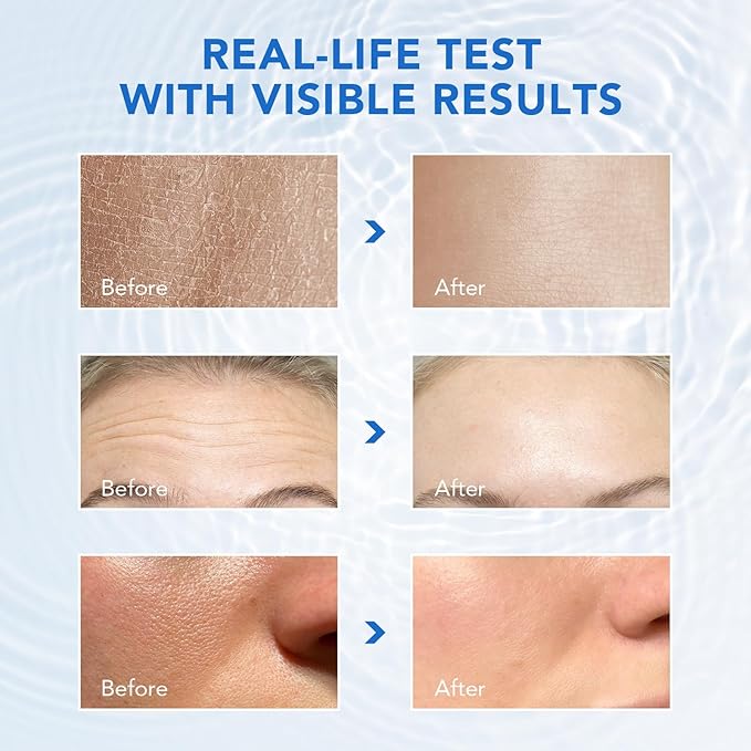 3% Hyaluronic Acid Serum Ultra-Hydrating Vials,Hyaluronic Acid, Hyaluronic Acid Serum for Face Serum for Women Anti Aging Single-Use Hyaluronic Acid Tubes Vials(1 Box of 30)