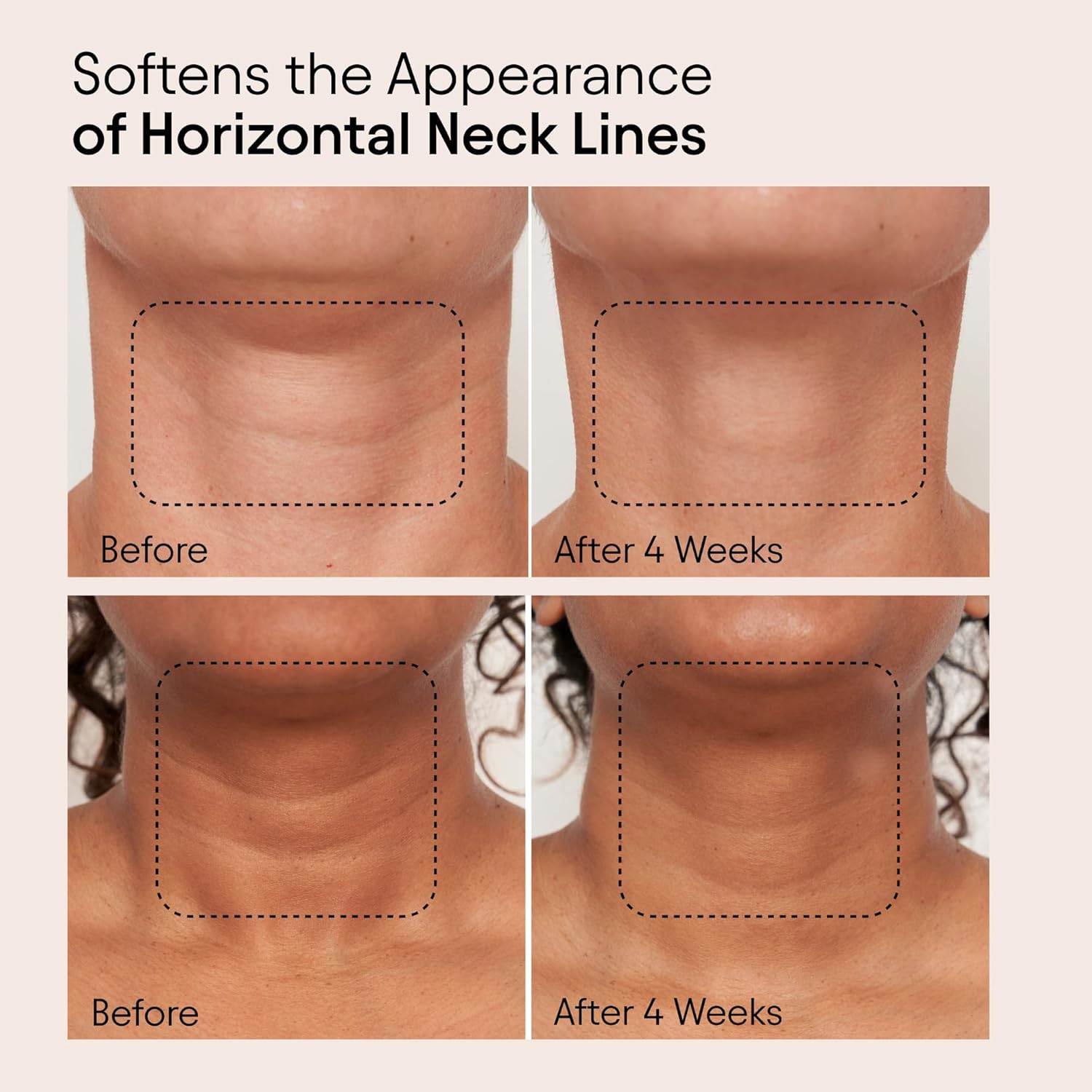 ALPYN Super Sculpt Serum, Face & Neck with Tri-Peptide Firming Complex, 1.7 oz