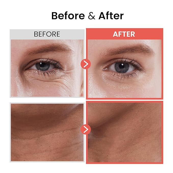 the SKIN HOUSE Wrinkle Supreme Serum 0.67 fl.oz + 1.69 fl.oz | Ginseng, Adenosine, Wrinkles, Fine Lines, Korean Skin Care