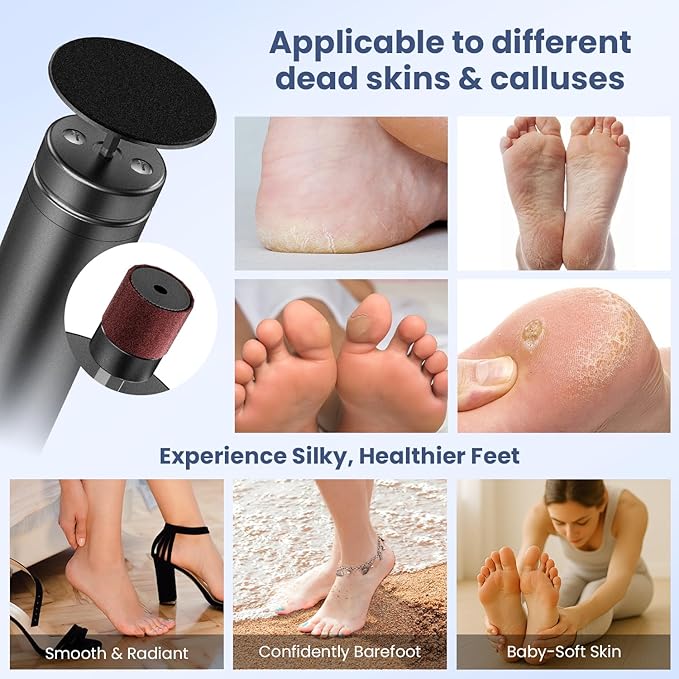 Electric Callus Remover for Feet, Adjustable Speed Foot Callus Remover, Professional Pedicure Tools for Feet with 60 Pcs Replacement Sandpaper Disc, Foot Scrubber for Dead Skin and Calluses