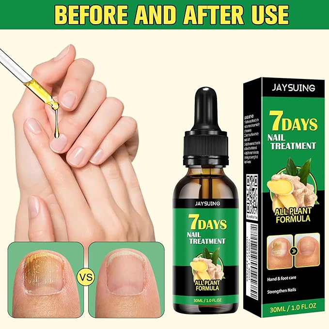 Ginger Nail Growth Serum, 7 Days Nail Treatment, Ginger Nail Treatment, Ginger Cuticle Care Oil for Strengthen & Promote Nail Growth (2Pcs)
