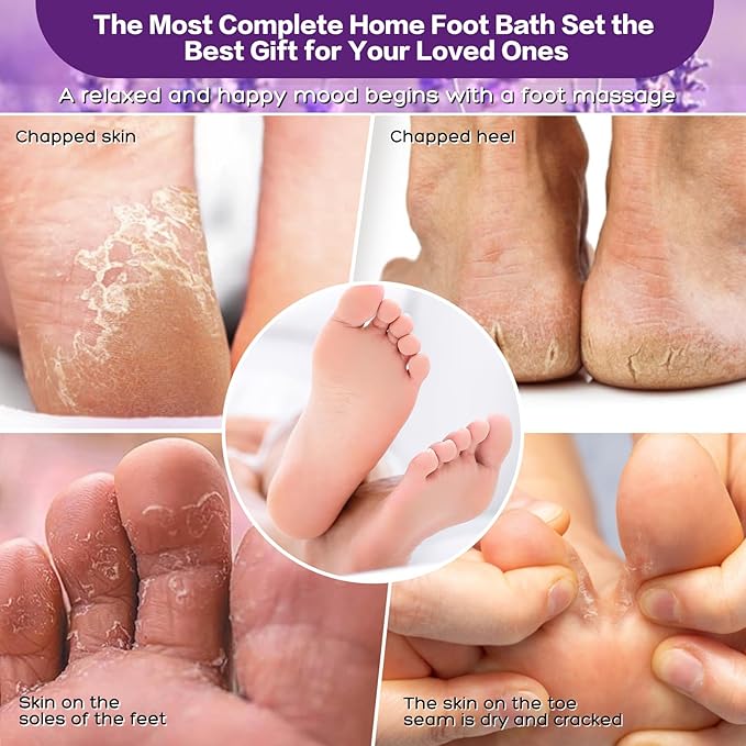 foot salt set Foot Soak with Epsom Salt - For Toenail Repair, Athletes Foot, Softens Calluses, Soothes Sore & Tired Feet…