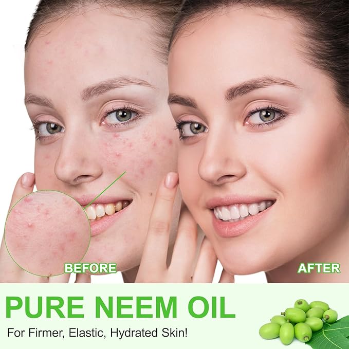 Neem Oil for Skin - 2 Pack, Pure Natural Cold Pressing, Free of Hexane, Nourishes the Skin and Hair, Reduces Fine Lines, 4.04 Oz