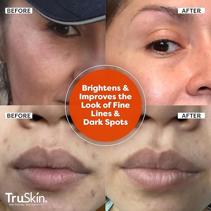 TruSkin Vitamin C Serum For Face – Anti Aging Formula with Vitamin C, Hyaluronic Acid, Vitamin E – Brightening Serum – Improve Appearance of Dark Spots, Tone, Fine Lines & Wrinkles, 2 Fl Oz