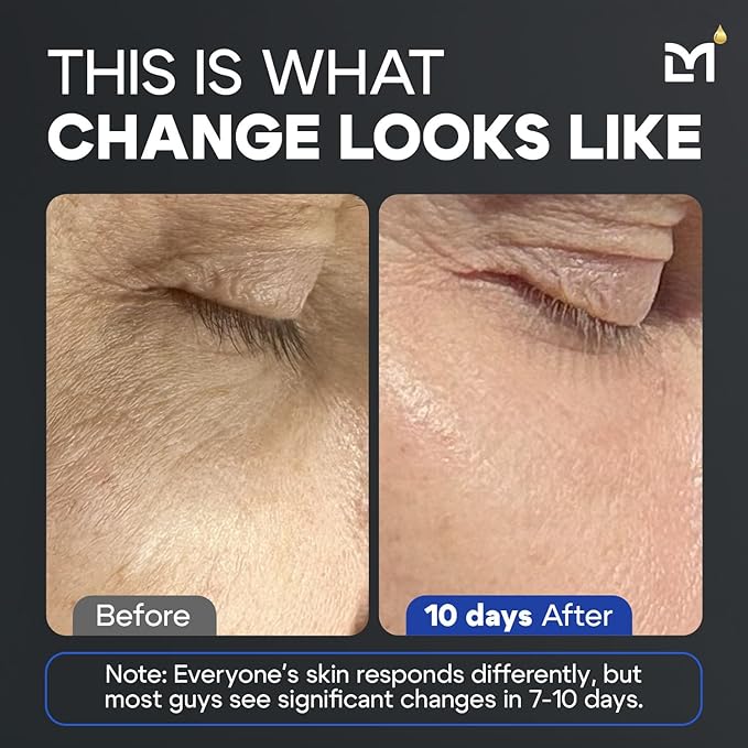 Titan High Potency Anti Aging Peptide Serum for Face - Men's Gentle Multi Peptide Moisturizer with Hyaluronic Acid, 5% Niacinamide, Vitamin C, Vitamin E, and Ceramides - Unscented, 1 Fl Oz