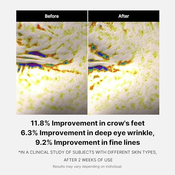 medicube Deep Reviving Peptide Eye Serum 1.01 Fl. Oz., | Eye Treatment Serum with Quadruple Peptides, Niacinamide, and Squalane | Reduces Signs of Aging and Fine Lines