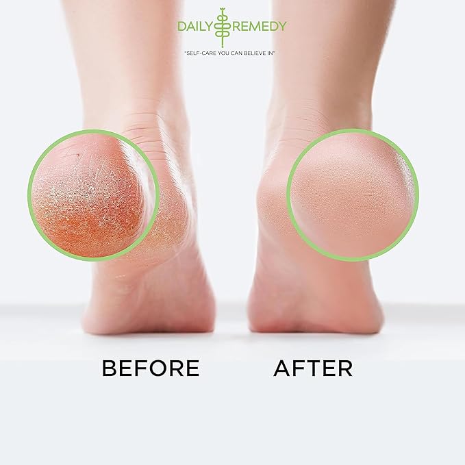 Tea Tree Oil Foot Soak with Epsom Salt - Made in USA - for Toenail Athletes Foot, Stubborn Foot Odor Scent, Softens Calluses & Soothes Sore Tired Feet - 16 Ounces