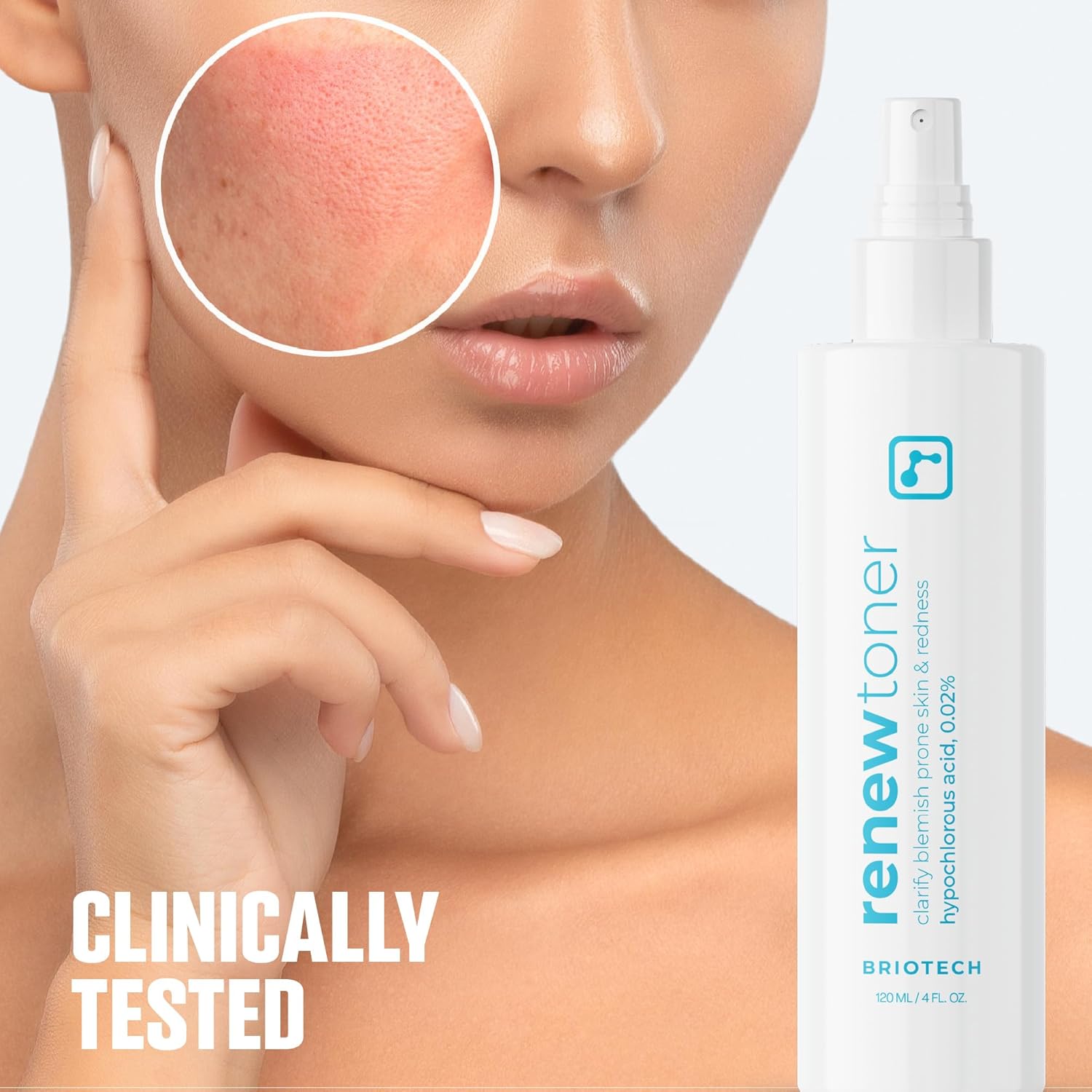 BRIOTECH Renew Toner, Hypochlorous Acid Spray, Minimize Appearance of Blemishes, Soothing Facial Mist for Sensitive Skin, Calm Redness & Bumps, Vegan, 4 fl oz (2 Pack)