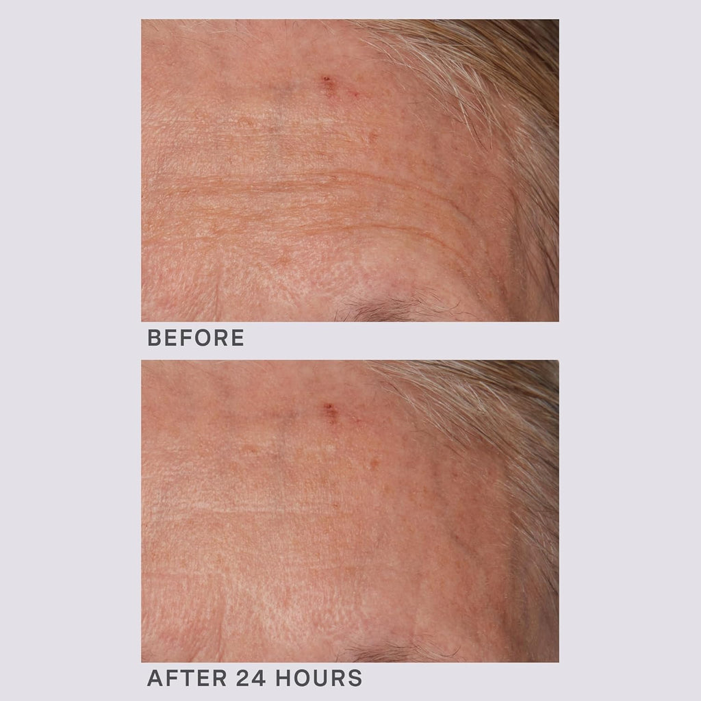 Lancer Gravity Defying Moisturizer With Firming Technology, Face Moisturizer for Women, Great at Boosting Collagen, Hydration, Anti-Aging and Firmness