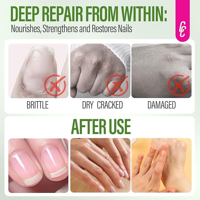 CHUCHU Nail Repair and Growth Serum: Natural Plant Strengthening Serum with Aloe Vera Scent - Nail Cuticle Care for Women Men Home Salon Gift