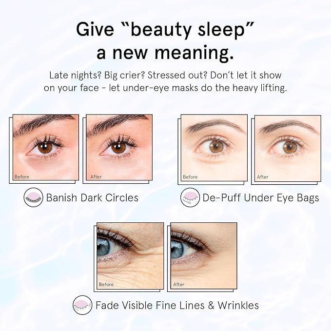 grace & stella Under Eye Patches for Puffy Eyes and Dark Circles (Retinol, 6 Pairs) Restoring Gel Under Eye Masks with Hyaluronic Acid - Vegan Cruelty-Free Skincare Birthday Gifts for Women