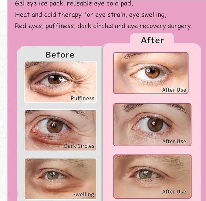 Eye Ice Pack, Gel Eye Ice Pack, Reusable Cold Compress for Migraine, Flexible Cooling Gel Pads for Eyes, Headaches and Post-Surgery Recovery, Cooling Eye Mask Cold and Hot Treatment Eye Strain（8pack）