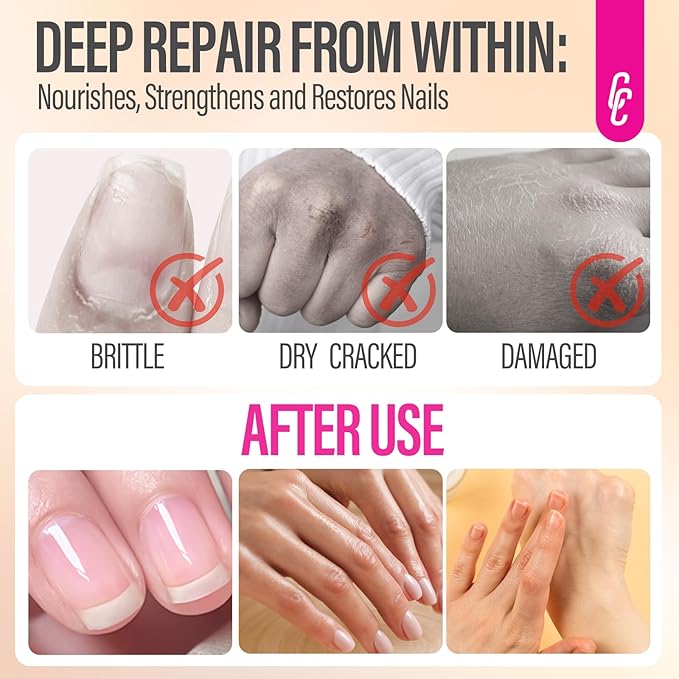 CHUCHU Nai Repair Serum: Natural Plant Growth and Strengthening Serum with Honey Milk Scent - Nail Cuticle Care for Women Men Home Salon Gift