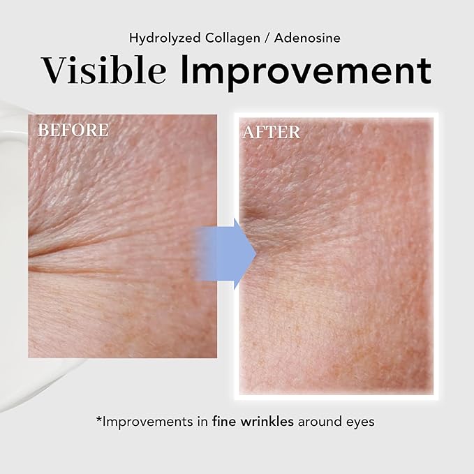 NOWATER Collagen Eye Cream for Wrinkles, Puffiness, Dark Circles - Hydrolyzed Collagen & Beta-glucan for Improved Under-eye Area, Korean Skincare (0.88 fl.oz)