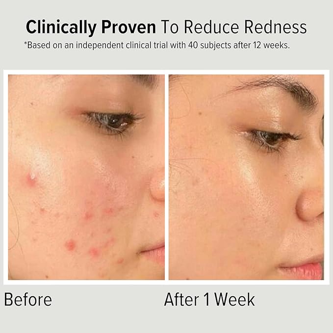 Niacinamide 10% Face Serum with Hyaluronic Acid, 2-in-1 Toning & Hydrating – Shrinks Pores, Reduces Inflammation, and Evenly Tones Skin – Anti-Aging & Hydrating Formula for All Skin Types