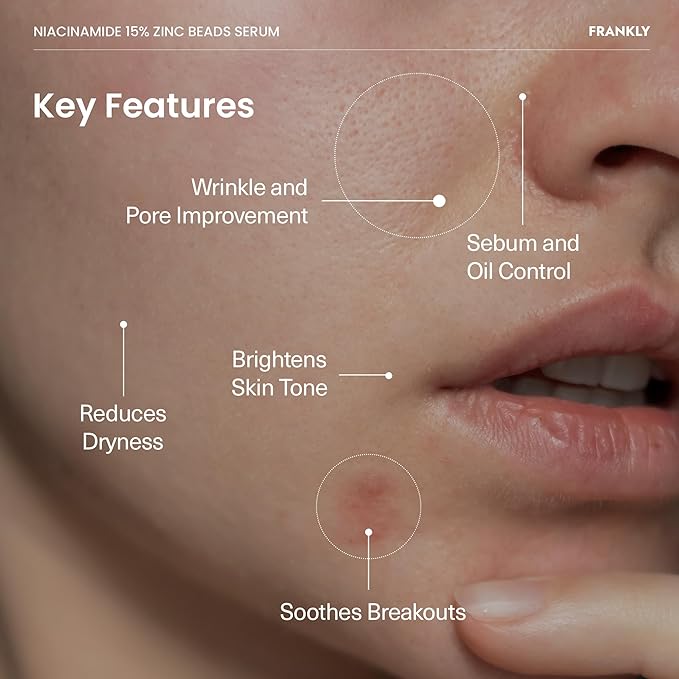 FRANKLY Niacinamide 15% & Zinc Beads Serum Jumbo: Acne & Dark Spots Care, Oil Control, Even Skin Texture & Glow | Vegan & Cruelty-Free | Non-Comedogenic All skin types Korean Skincare | 2.02 fl.oz