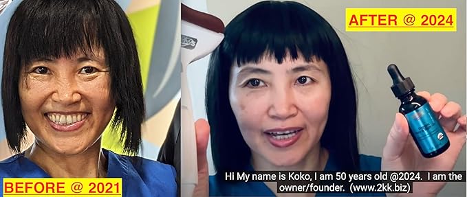 KOKOS Organic face and body oil, scar, stretch mark,Rosehip, Wheat Germ, Argan, Tamanu, Carrot, Rosemary, Lavender, Geranium, Patchouli, Sage oil