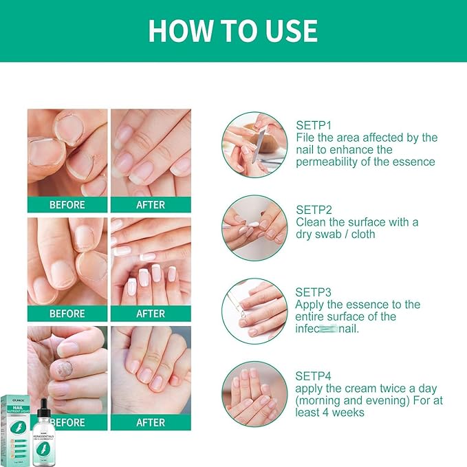 Kerassentials Toenail Oil, Kerassentials Nails colourless (3PCS)