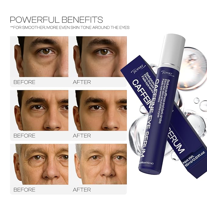 Eye Bags Treatment for Men: Depuffing and Firming - Hydrates and Nourishes The Delicate Eye Area for Daily Use by Men 15ml