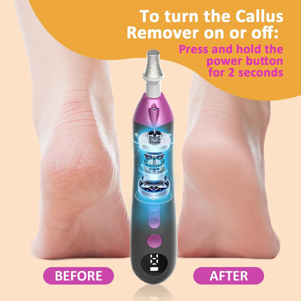Callus Remover for Feet, Electric Foot Callus Remover - 8 Grinding Heads, 9 Speeds, Rechargeable Foot File - Professional Pedicure Tool for Hard Skin, Calluses & Cracked Feet