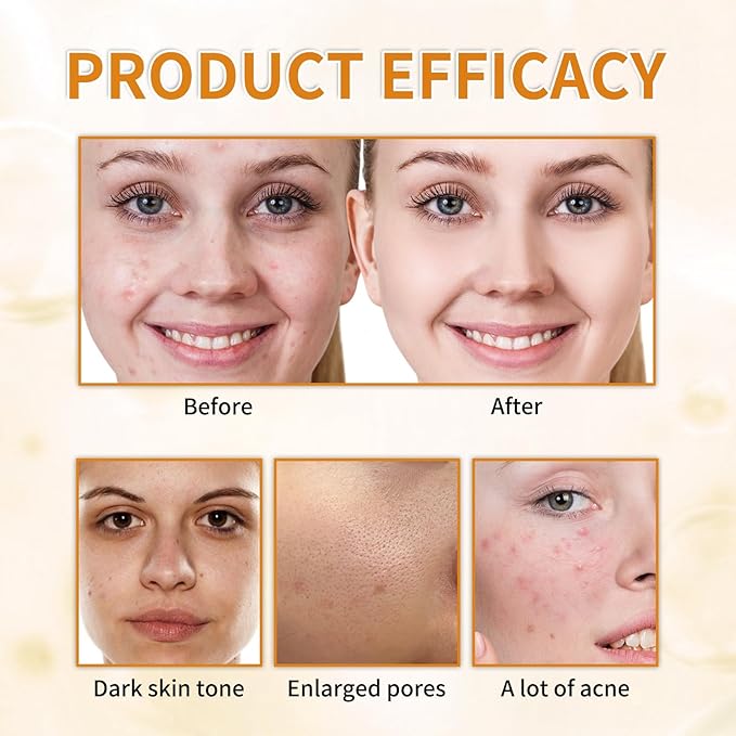 7% Glycolic Acid Exfoliating Toner, Exfoliating Facial Toner, Smooth Skin, Even Tone, Hydrating Formula, Pore Minimizer (Large, Unscented)