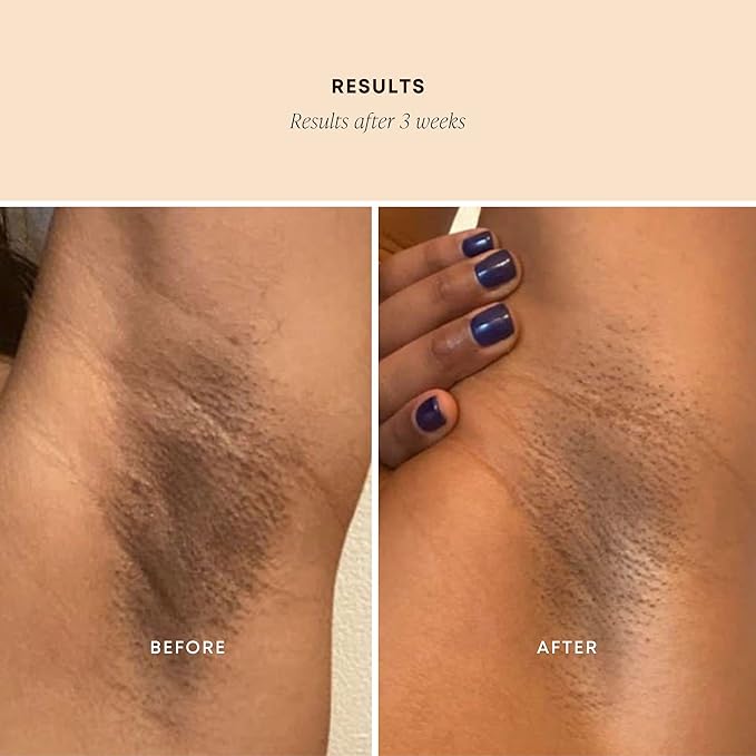 Bushbalm Dark Spot Exfoliating Scrub - Natural Body Scrub Exfoliant to Hydrated, Soften and Enhance Glow in Skin - Bermuda 236 ml