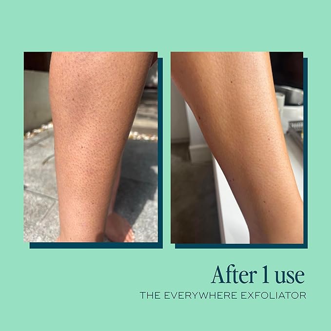 Gentle Body Exfoliator | Hydrating Acid-Based Scrub for Women | With Glycolic Acid, Lactic Acid, Rice Powder & Vitamin E | Smooths, Softens & Evens Tone | pH-Balanced & Vegan, 180ml