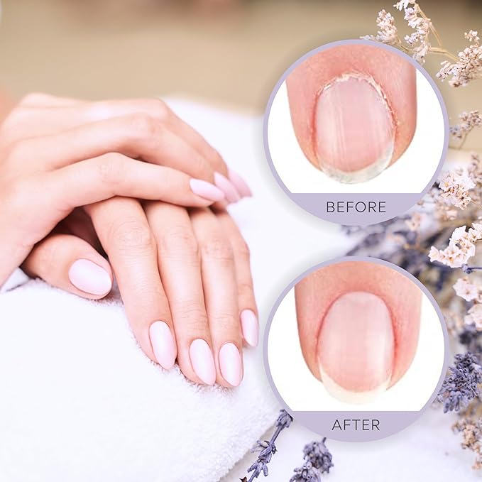 C CARE Sweet Almond Roll-On Cuticle Oil | Natural Revitalizing Hydrating Nail Oil For Repaired Cuticles Overnight | Remedy For Damaged Skin And Thin Nails | Paraben Cruelty Free Formula | 10ml