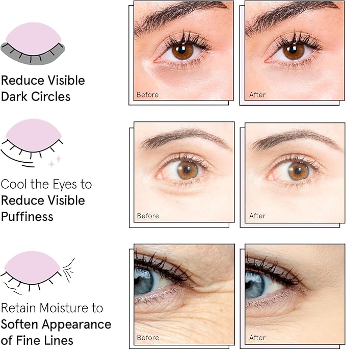 Under Eye Mask - Reduce Dark Circles, Puffy Eyes, Undereye Bags, Wrinkles - Gel Under Eye Patches, Vegan Cruelty-Free Self Care by grace and stella (72 Pairs, GoldPinkBlue)24 Pair (Pack of 3)