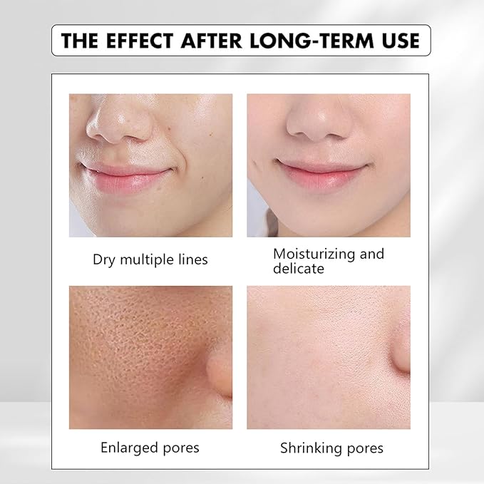 Crema De Baba De Caracol Original, 92% Snail Mucin Moisturizer Korean Skin Care Set, Snail Mucin Serum, Vitamin C Facial Serum, Double Care Facial Cleanser, Crema Baba De Caracol Original