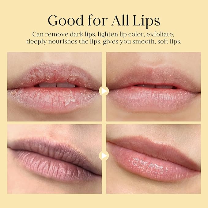 Turmeric Lip Treatment Kit for Dark Lips, Sugar Lip Scrub&Lip Balm for Smokers, Lip Exfoliator Scrub for Hydration Chapped and Cracked Peel Lips