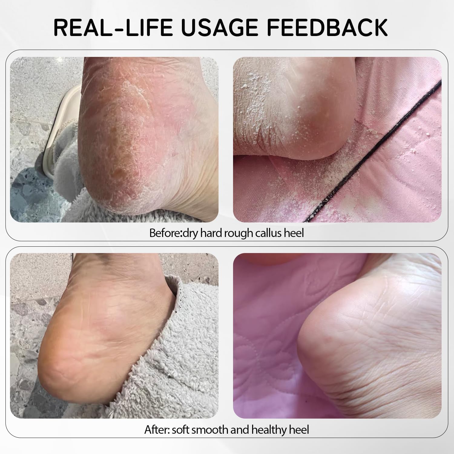 Cordless Electric Foot Callus Remover,Rechargeable Grinder Tool for Feet Dead Skin,Professional Pedicure File Heel Sander Tools with 60pcs Sandpaper Pads(Black)