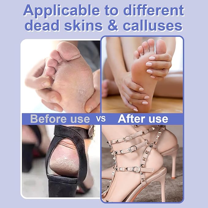 Electric Foot File - High Torque,Callus Remover for Feet,Adjustable Speed Foot File with 60 Pcs Sandpaper Discs,Professional Pedicure Tool for Dead Skin and Calluses (Blue)