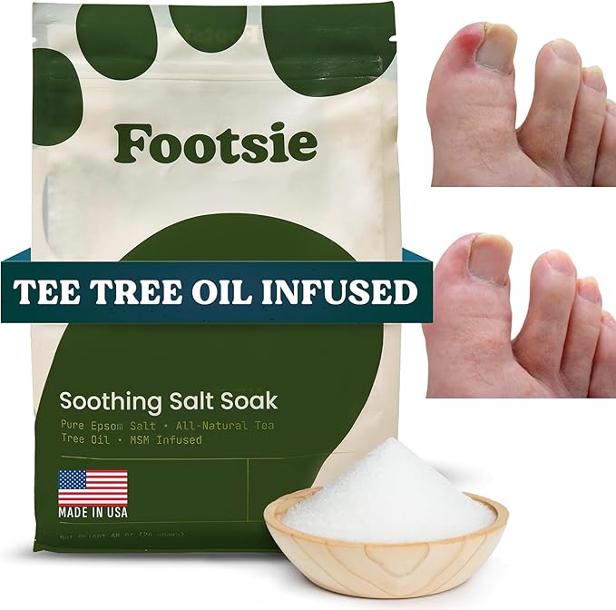Footsie Soothing Tea Tree Oil Epsom Salt Soak - for Calluses, Aches & Pain, Athlete's Foot - Made in USA - Soothes Cracked Heels, Flaky Skin - 100% Organic, Pedicure Spa Salt (Toenail Repair)