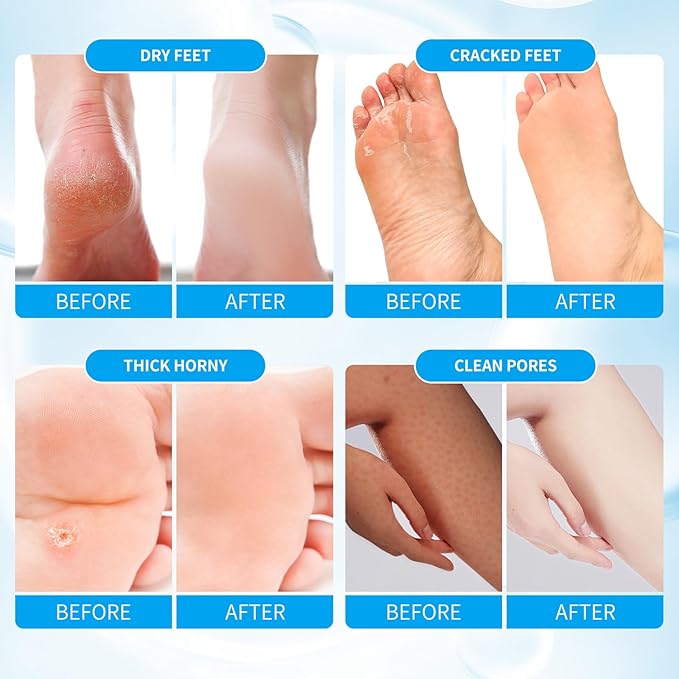 Pedicure Kit Foot Soak Set: Bubble Salt, Sugar Scrub, Massage Mask, Massage Lotion in a Box, 4 Step Foot Spa Kit for Dry Feet, Softens Calluses(1 Set Pacific Waves)