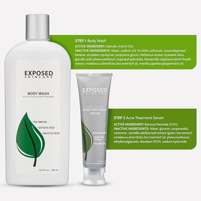 Exposed Skin Care Body Acne Kit – Dual Acne Treatment Serums + Body Wash and Exfoliating Body Cloth – Powerful System Eliminates Pimples and Breakouts to Quickly Clear Back and Body Acne